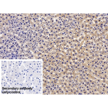 C Reactive Protein (CRP) Human Monoclonal Antibody