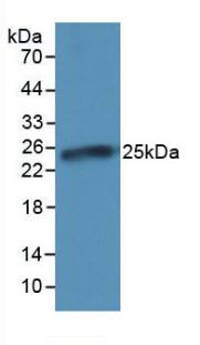 C Reactive Protein (CRP) Pig Monoclonal Antibody