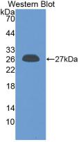 C Reactive Protein (CRP) Rat Monoclonal Antibody