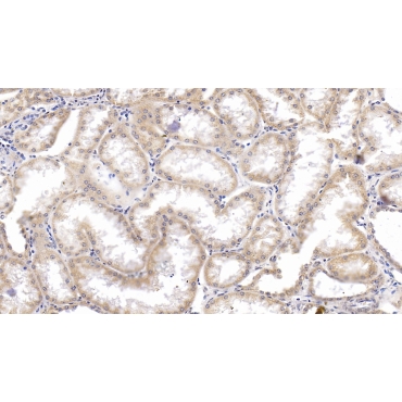 Heat Shock Protein 60 (Hsp60) Human Monoclonal Antibody