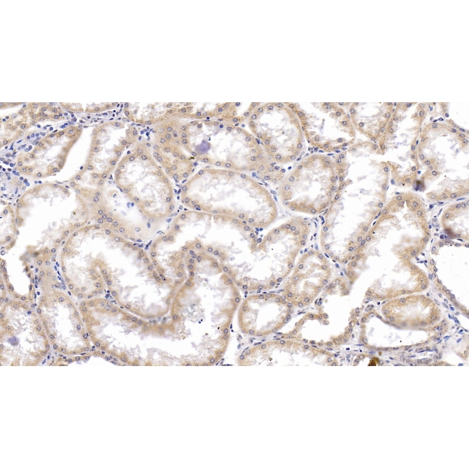 Heat Shock Protein 60 (Hsp60) Human Monoclonal Antibody
