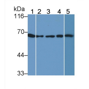 Heat Shock Protein 60 (Hsp60) Human Monoclonal Antibody