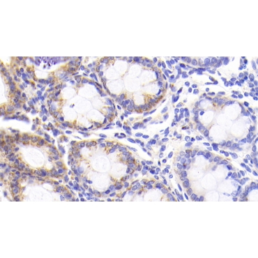 Heat Shock Protein 60 (Hsp60) Human Monoclonal Antibody