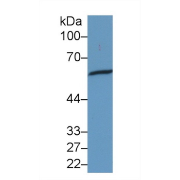 Heat Shock Protein 60 (Hsp60) Human Monoclonal Antibody