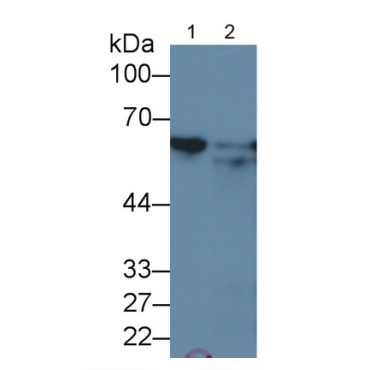 Heat Shock Protein 60 (Hsp60) Human Monoclonal Antibody