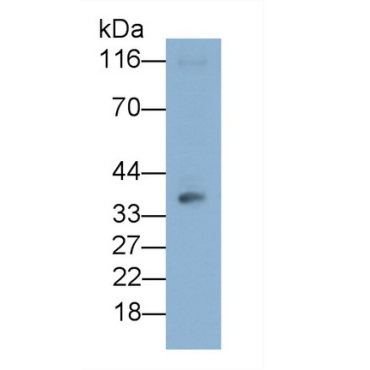 Cluster Of Differentiation 86 (CD86) Human Monoclonal Antibody