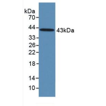 Follicle Stimulating Hormone (FSH) Human Monoclonal Antibody