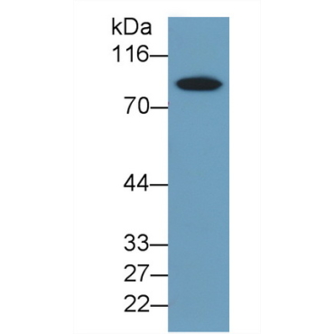 Thrombin/Antithrombin Complex (TAT) Human Monoclonal Antibody