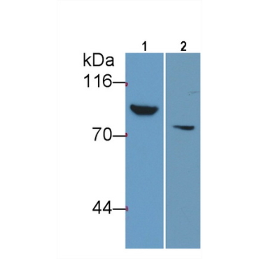 Thrombin/Antithrombin Complex (TAT) Human Monoclonal Antibody