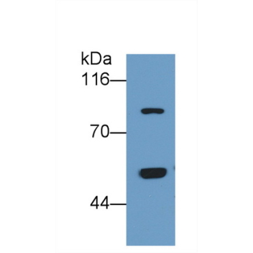 Thrombin/Antithrombin Complex (TAT) Human Monoclonal Antibody