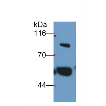 Thrombin/Antithrombin Complex (TAT) Human Monoclonal Antibody