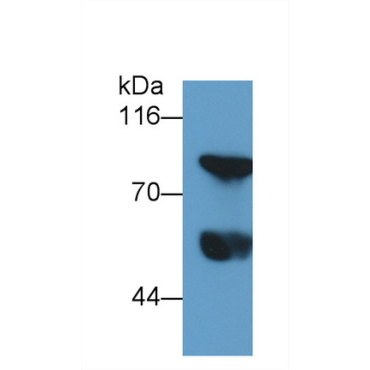 Thrombin/Antithrombin Complex (TAT) Human Monoclonal Antibody