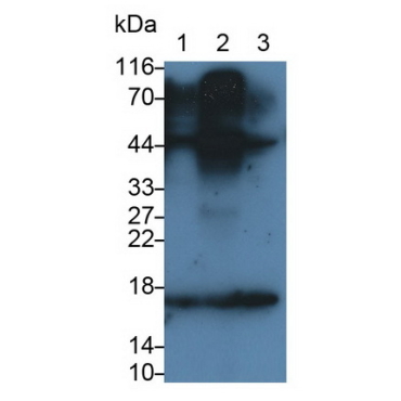 Corticotropin Releasing Factor (CRF) Human Monoclonal Antibody