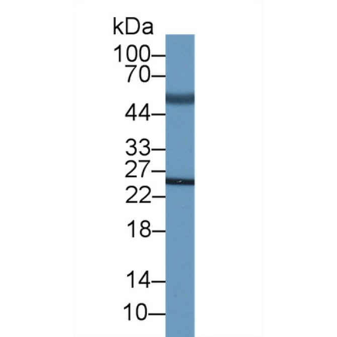 Adrenocorticotropic Hormone (ACTH) Human Monoclonal Antibody
