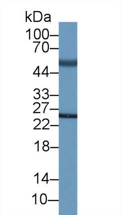 Adrenocorticotropic Hormone (ACTH) Human Monoclonal Antibody