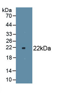 Nitric Oxide Synthase 2, Inducible (NOS2) Rat Monoclonal Antibody