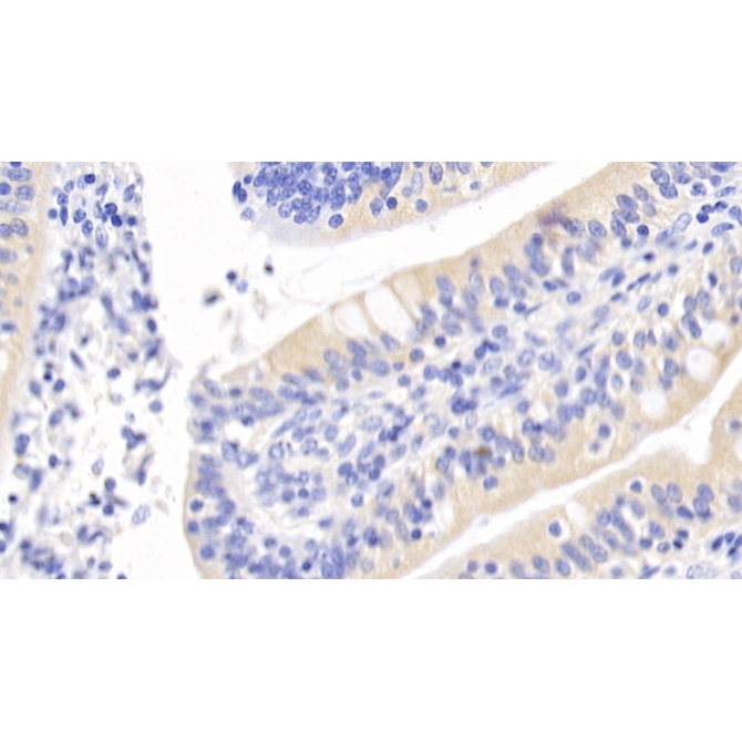 Inhibin Beta A (INHbA) Human Monoclonal Antibody