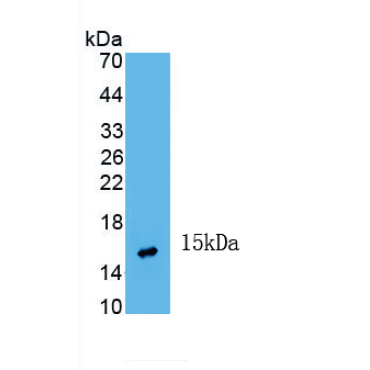 Inhibin Beta A (INHbA) Human Monoclonal Antibody