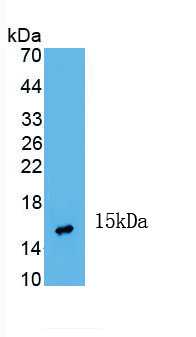 Inhibin Beta A (INHbA) Human Monoclonal Antibody