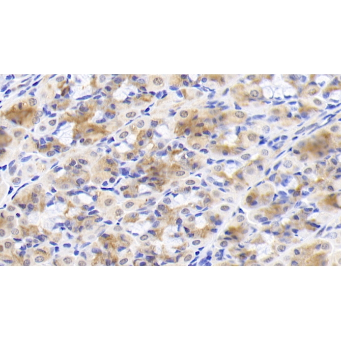 Inhibin Beta A (INHbA) Human Monoclonal Antibody