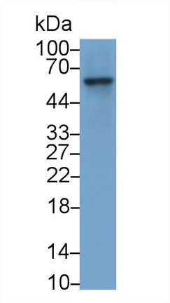 Coagulation Factor IX (F9) Rabbit Monoclonal Antibody