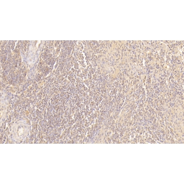Resistin (RETN) Human Monoclonal Antibody