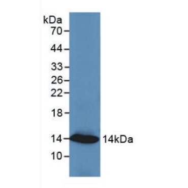 Resistin (RETN) Human Monoclonal Antibody