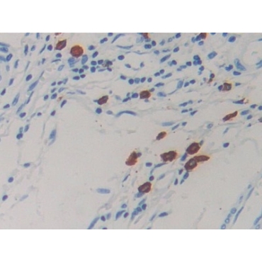 Resistin (RETN) Human Monoclonal Antibody