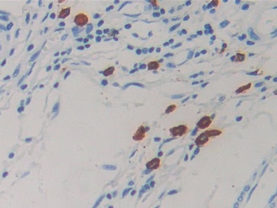 Resistin (RETN) Human Monoclonal Antibody