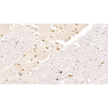 Resistin (RETN) Human Monoclonal Antibody