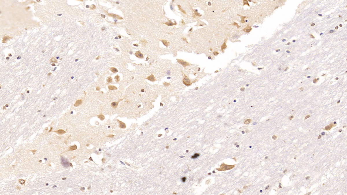 Resistin (RETN) Human Monoclonal Antibody