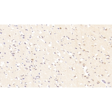 Resistin (RETN) Human Monoclonal Antibody