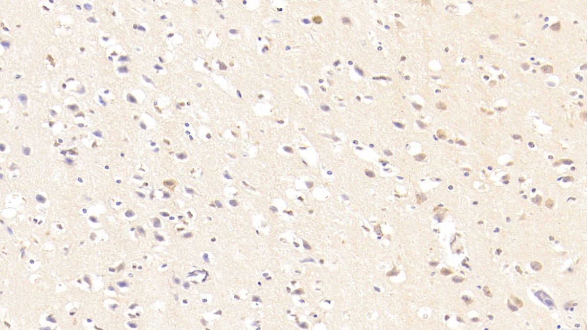 Resistin (RETN) Human Monoclonal Antibody