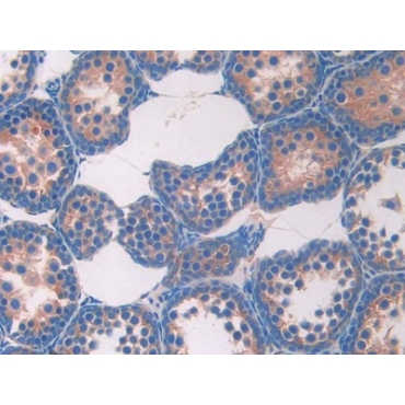 Resistin (RETN) Mouse Monoclonal Antibody