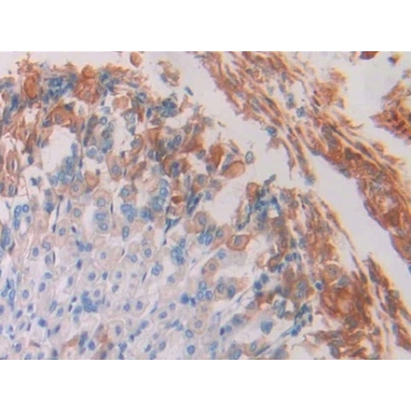 Resistin (RETN) Mouse Monoclonal Antibody