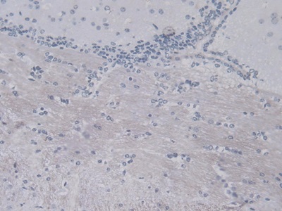 Resistin (RETN) Mouse Monoclonal Antibody