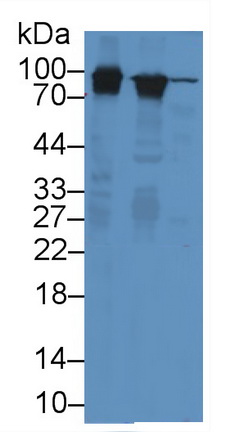 Glycogen Phosphorylase, Liver (PYGL) Rat Monoclonal Antibody
