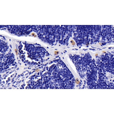 Caspase 8 (CASP8) Human Monoclonal Antibody