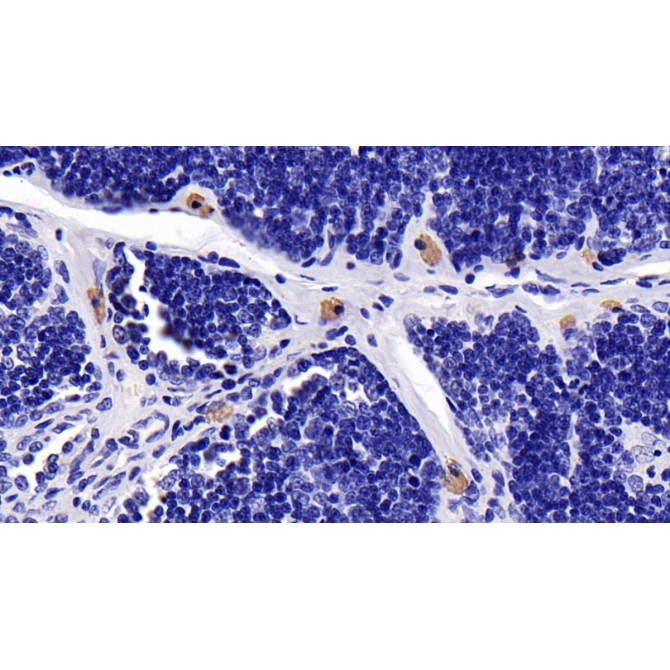 Caspase 8 (CASP8) Human Monoclonal Antibody