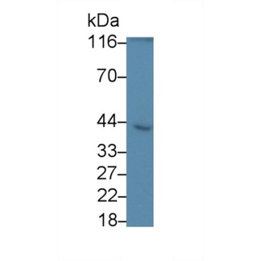 Caspase 8 (CASP8) Human Monoclonal Antibody