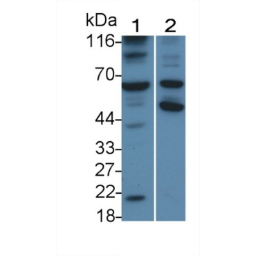 Caspase 8 (CASP8) Human Monoclonal Antibody