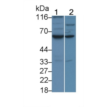 Caspase 8 (CASP8) Human Monoclonal Antibody