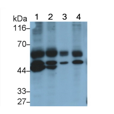 Caspase 8 (CASP8) Human Monoclonal Antibody