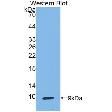 Clara Cell Protein 16 (CC16) Human Monoclonal Antibody