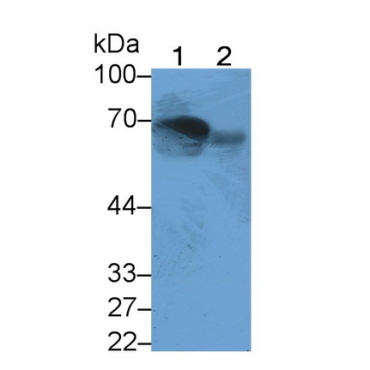 Mannose Associated Serine Protease 2 (MASP2) Human Monoclonal Antibody