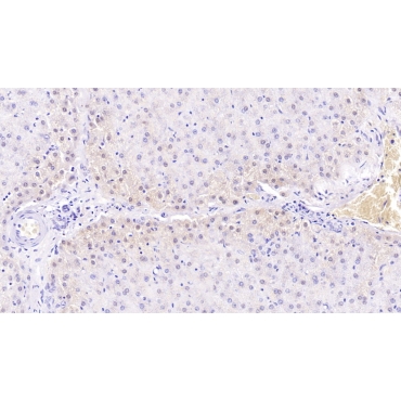 Mannose Associated Serine Protease 2 (MASP2) Human Monoclonal Antibody