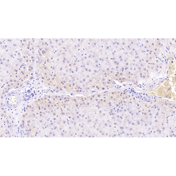 Mannose Associated Serine Protease 2 (MASP2) Human Monoclonal Antibody