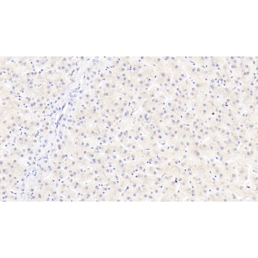 Mannose Associated Serine Protease 2 (MASP2) Human Monoclonal Antibody