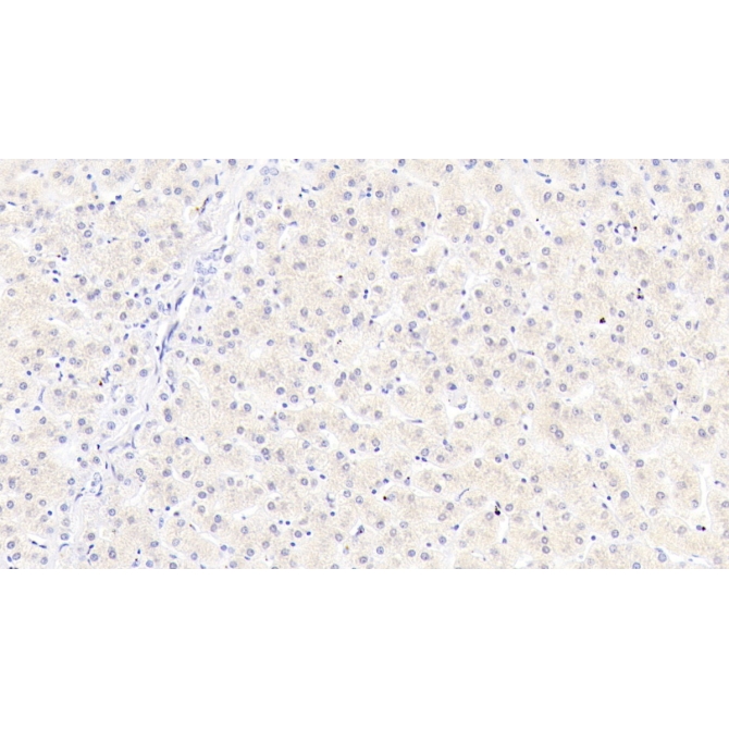 Mannose Associated Serine Protease 2 (MASP2) Human Monoclonal Antibody