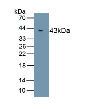 Heat Shock Protein 70 (HSP70) Human Monoclonal Antibody